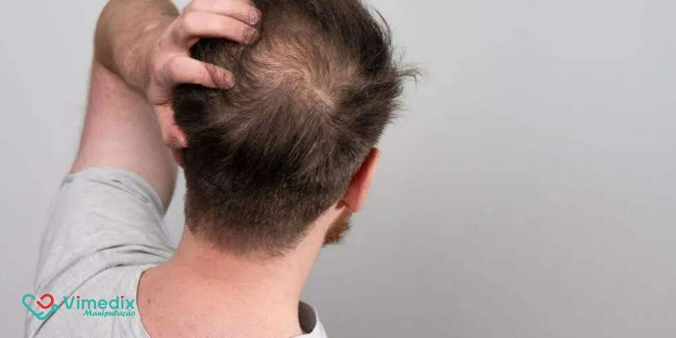 Kit Sansão: Solução Completa com Minoxidil + Cápsulas Revitalizadoras