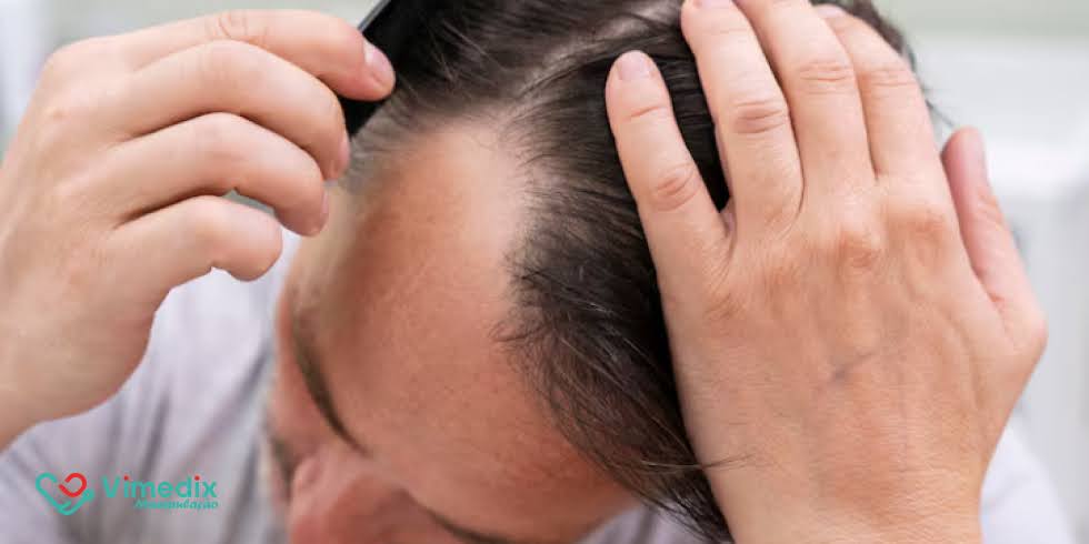 Kit Sansão: Solução Completa com Minoxidil + Cápsulas Revitalizadoras