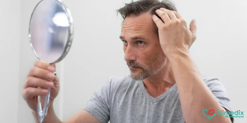 Spray Antiqueda Capilar: Minoxidil + Finasterida para Fios Mais Fortes e Volumosos  
