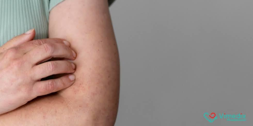 Saúde Intestinal e Pele em Harmonia: O Segredo dos Lactobacillus
