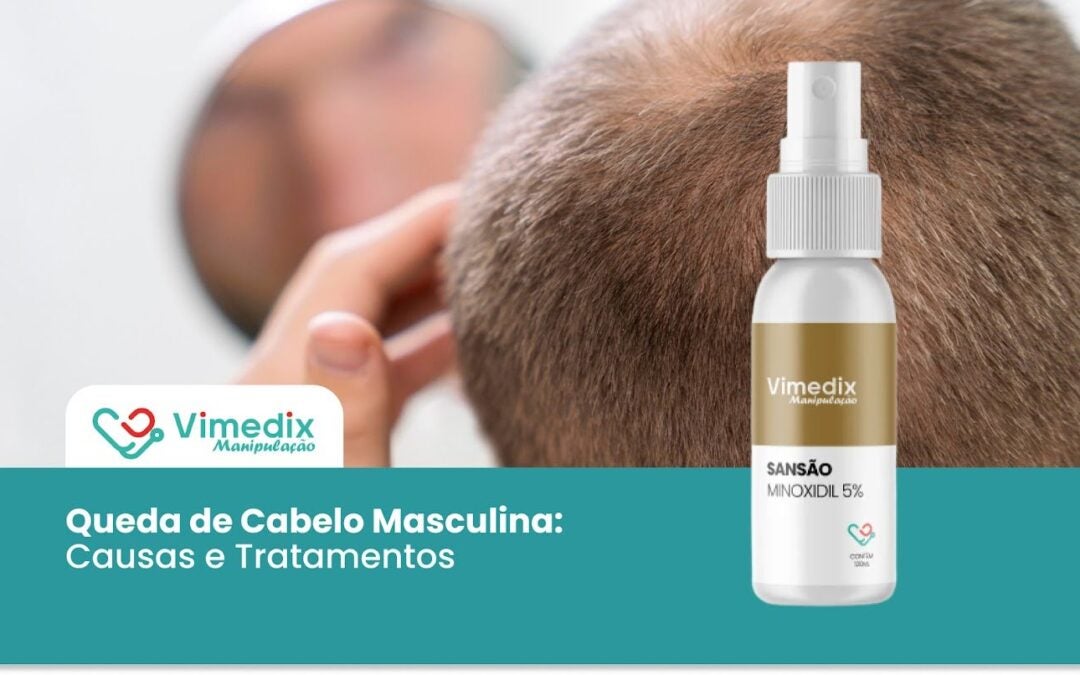 Queda de Cabelo Masculina: Causas e Tratamentos